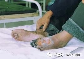 正确认识糖尿病：[ 糖尿病不是病 ]插图3